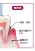 歯周病のお悩み